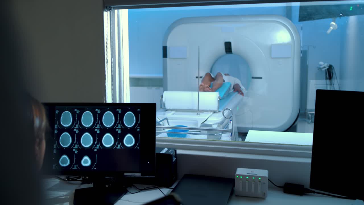 Tecnico che posiziona il paziente e avvia lo scorrimento del lettino nello scanner, mentre il medico esamina le scansioni cerebrali.