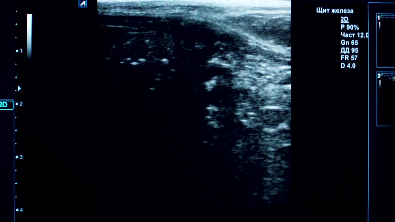 수의학 클리닉에서 초음파 진단