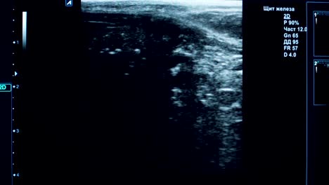 diagnóstico por ultrasonido en una clínica veterinaria
