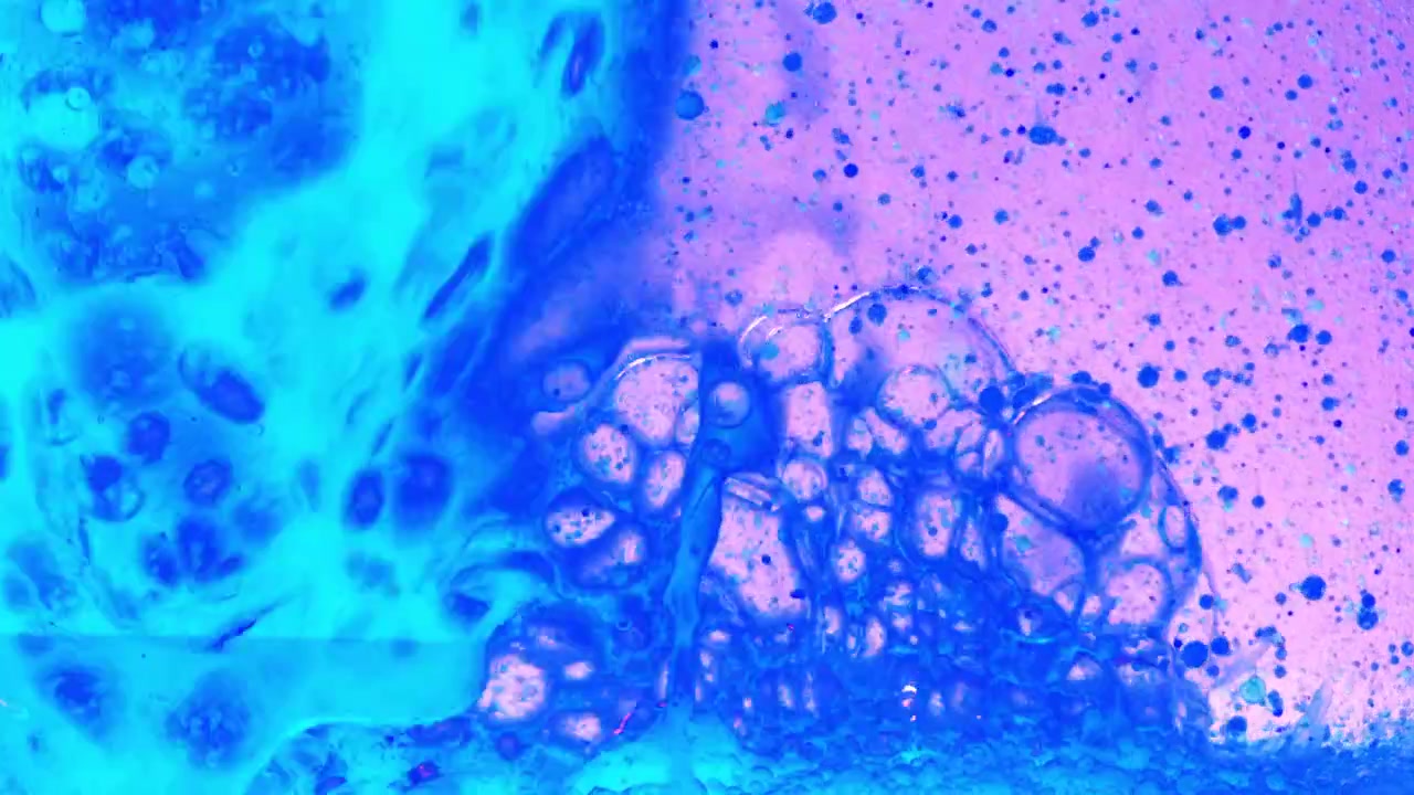 Background from bubbles. Motion of bubbles.