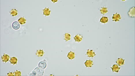 microscopic view of spiky spherical objects and a multi-celled organism
