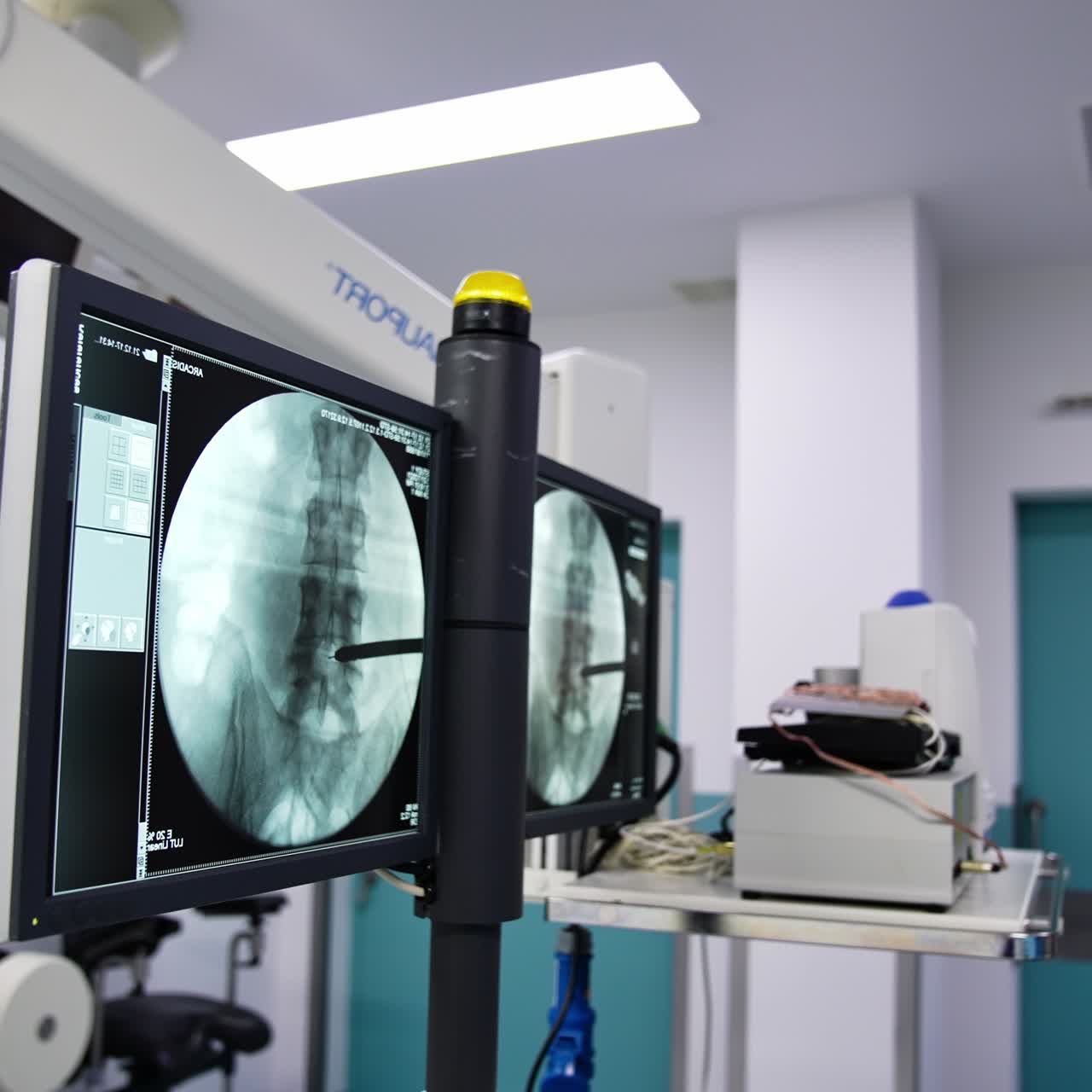 Monitor in the surgery room showing spine x-ray shot of a patient. Up-to-date technological surgery room with numerous modern appliances and devices