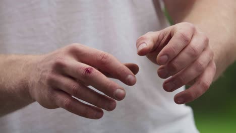 Person-Showing-His-Hands-With-A-Small-Wound-On-Fingers