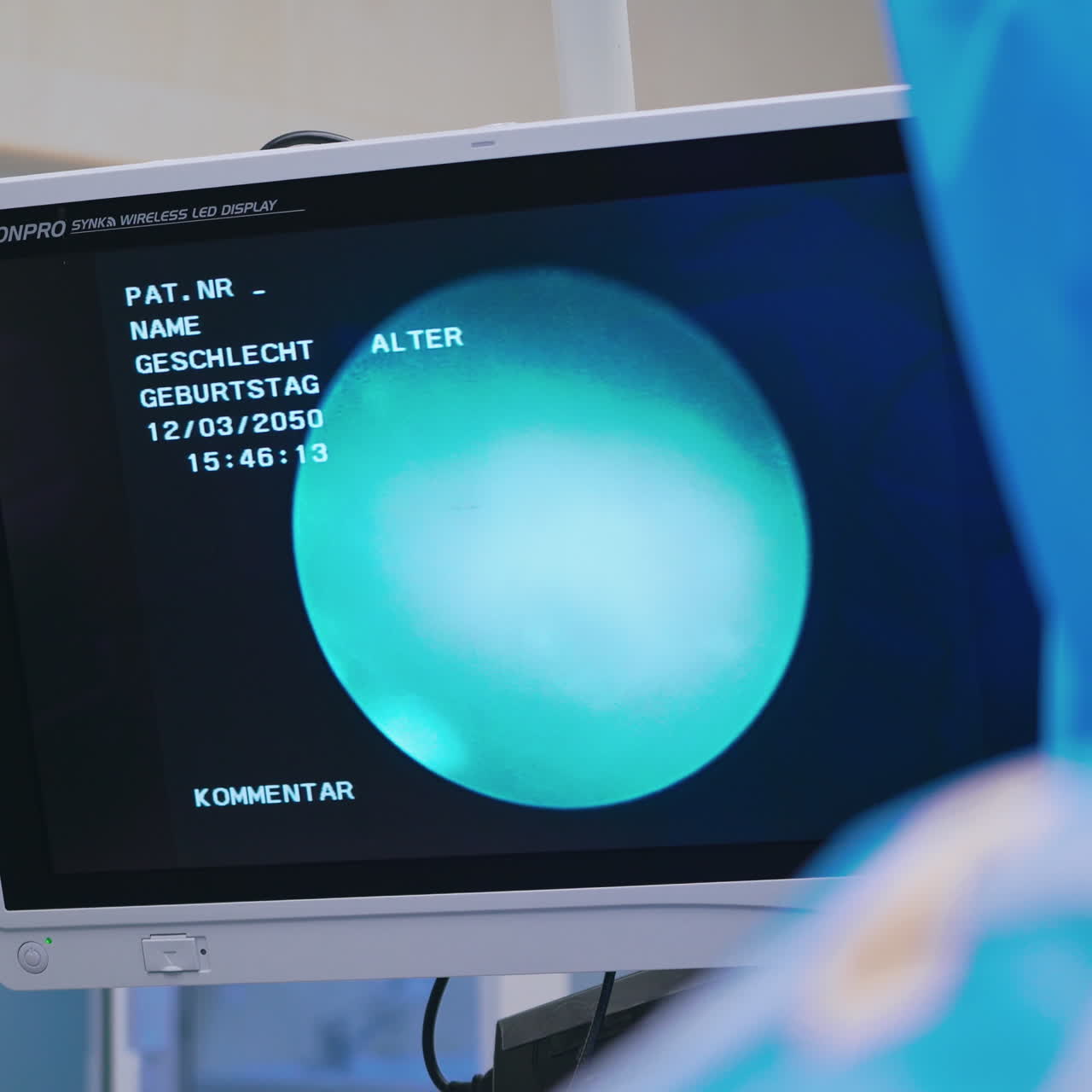 New technologies in clinic. Laparoscopic surgery on the screen of monitor in the operating room. Health care concept.