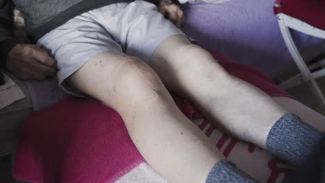 leg with surgical scar after knee surgery