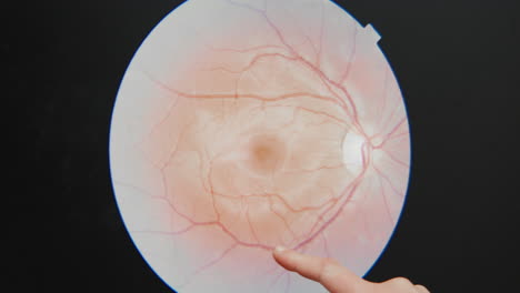 female eye doctor optician optometrist shows client patient damages in eyes blood vessels at health care check up need prescription for glasses surgical medical eye laser pupils blind blindness old