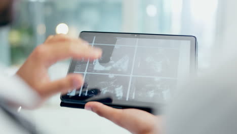 Doctor,-hands-and-tablet-with-x-ray-in-meeting