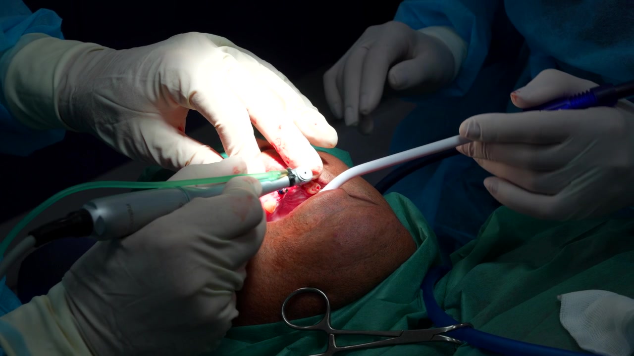Odontologist placing and screwing an implant in a patient's mouth. Close up