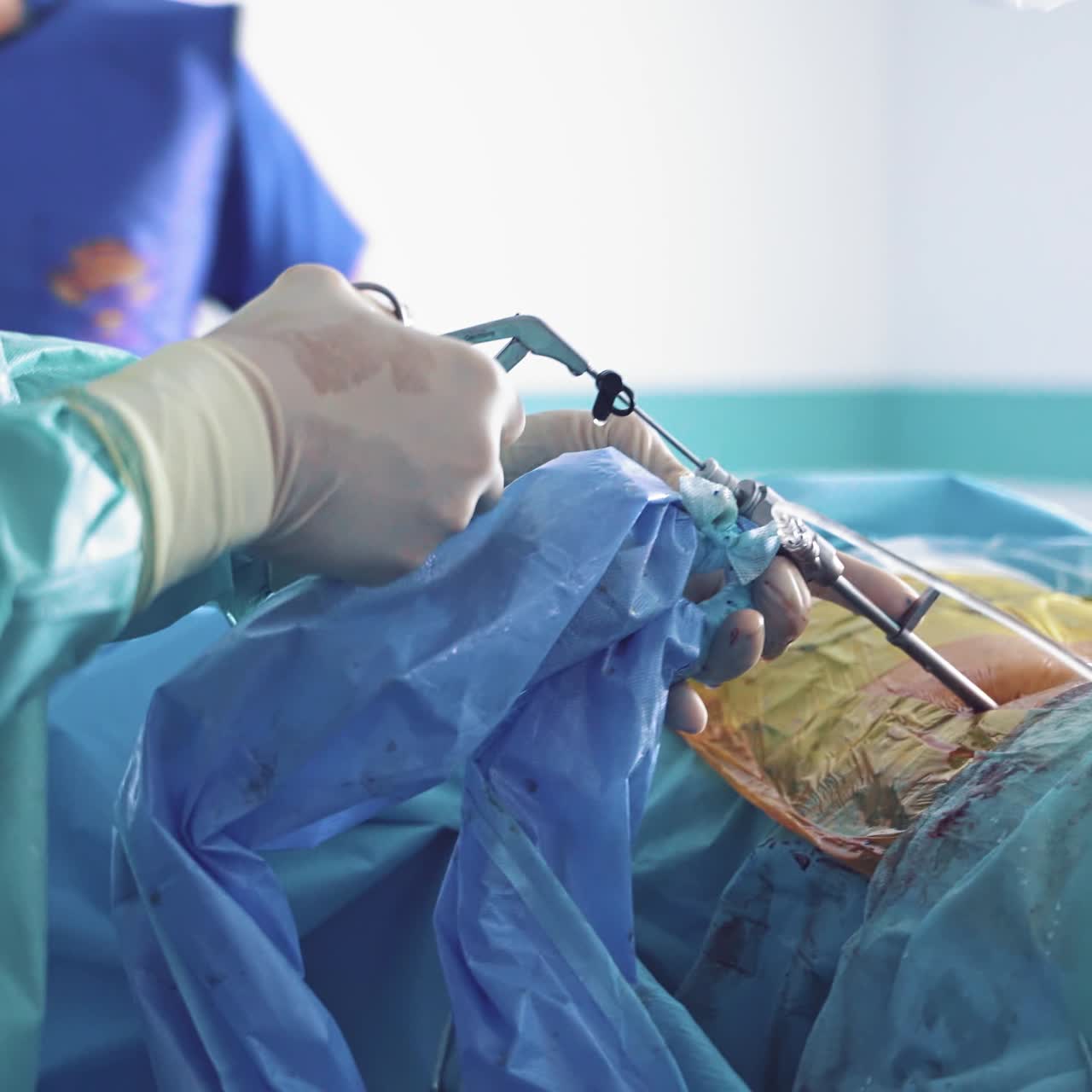 Doctors operate on patient