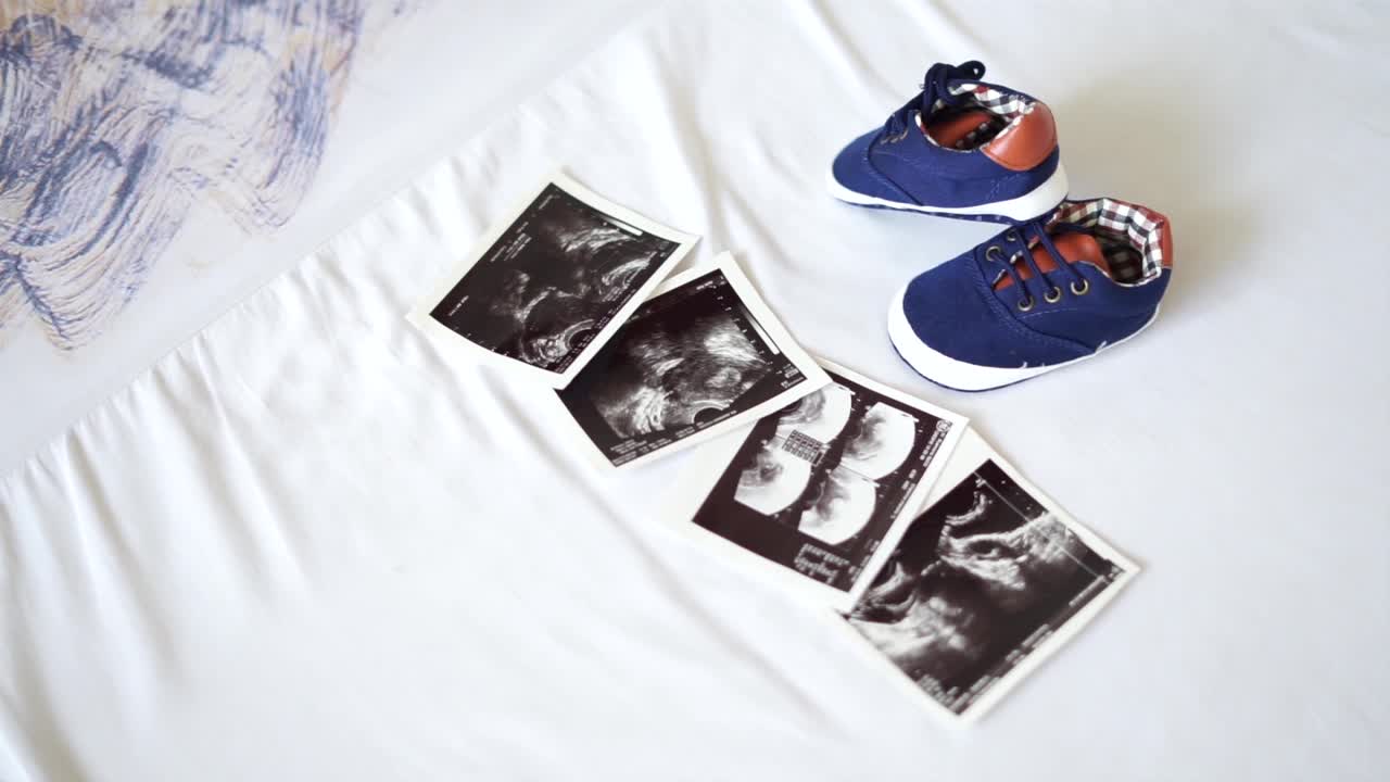 Scarpine da neonato e foto dell'ecografia. Concetto: in attesa della nascita di un bambino