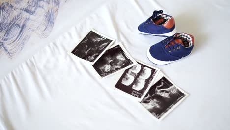 baby shoes and ultrasound photo. waiting for the birth of a baby concept