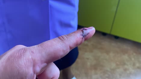 finger being cleaned and wrapped in bandage at home by nonmedical caregiver, reveal of stitches