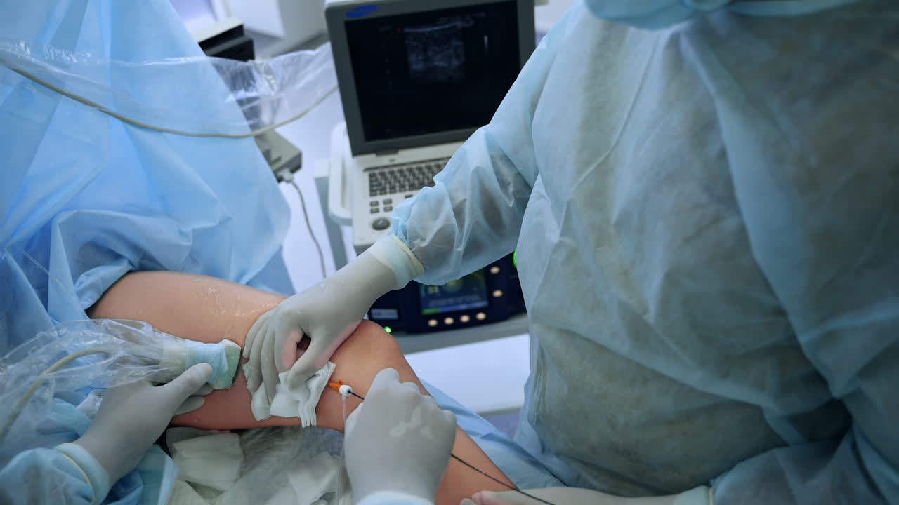 Operation on veins of a patient. Gloved hands of doctors apply equipment and look at the screen. Top view.
