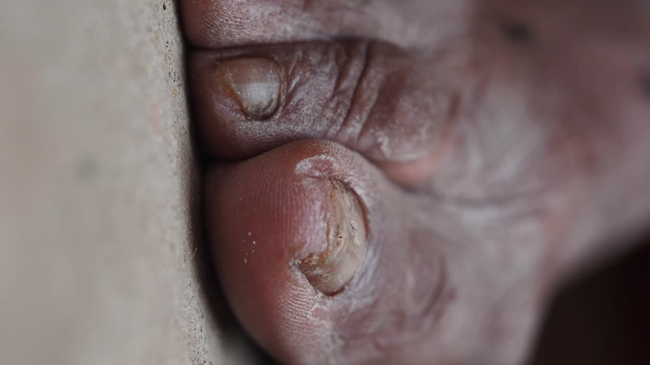 Close-up of aged toes