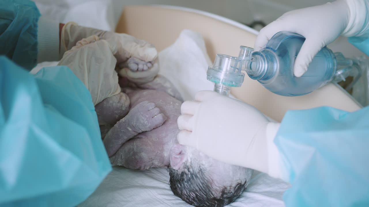 reanimación de recién nacidos