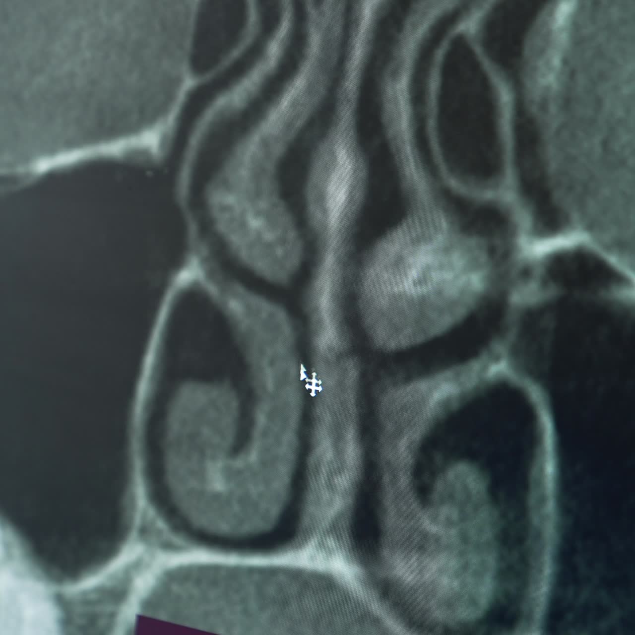 Body scan tomography for detecting illnesses. Grey shot of a screen at modern equipment. Close up