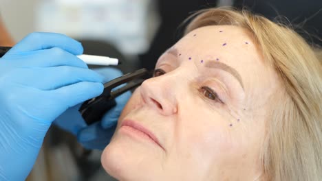 cosmetic procedure - marking face for injection