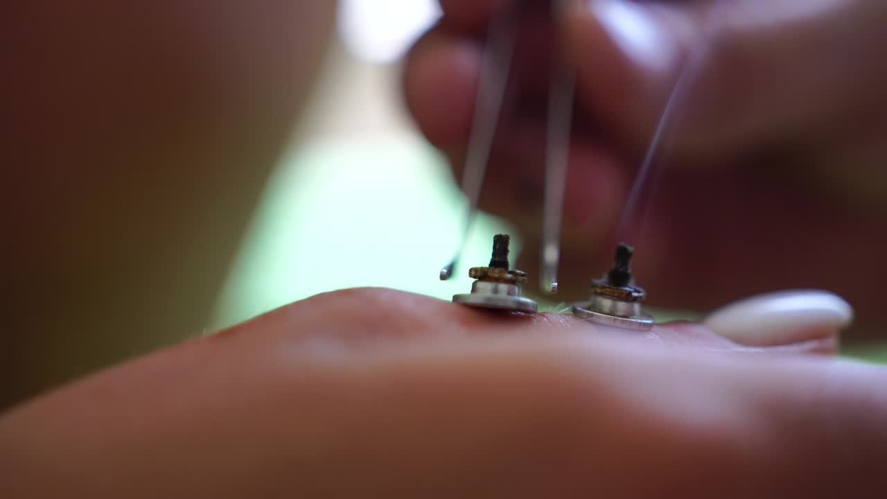 Therapist performing moxibustion procedure at health center. Moxibustion is a thermal effect on biologically active points located across the entire surface of the human body