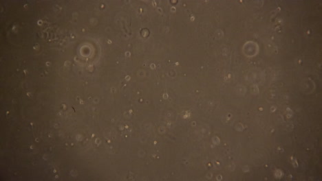 las células espermáticas mueren después de no haber fertilizado un óvulo