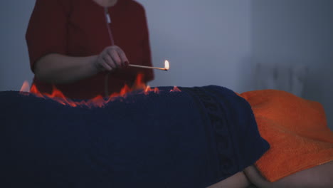 therapist burns flame on patient back with towel in clinic