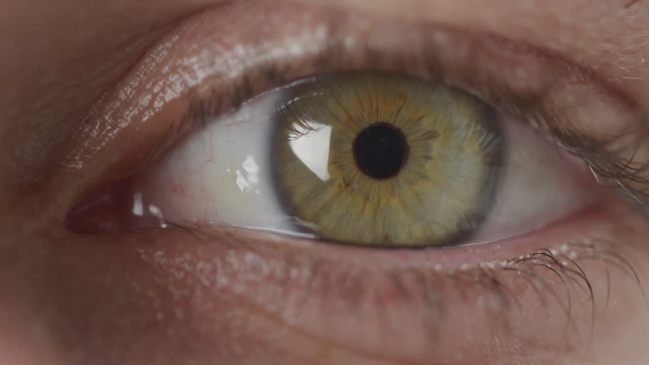 녹색 눈이  ⁇ 박이고