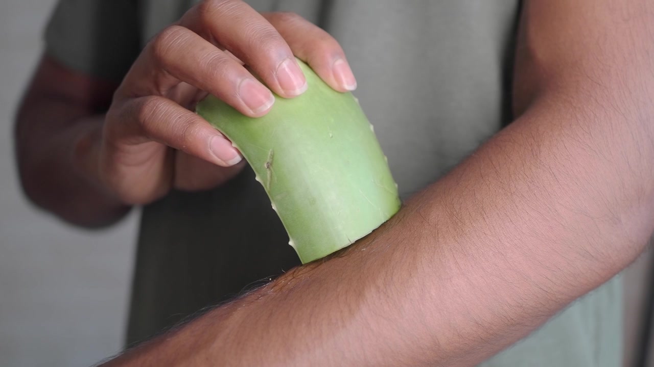 Person Applying Fresh Aloe Vera Gel to Skin