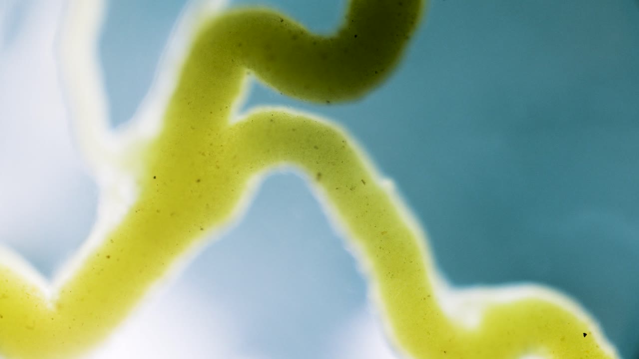 Slime mold plasmodium under microscope