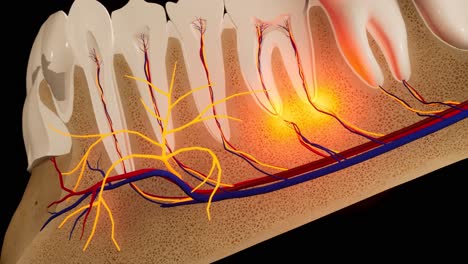 dolor de dientes. sección anatómica detallada de los dientes. inflamación del nervio. animación en 3d
