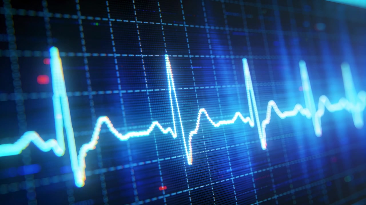 Avvio della riproduzione, traccia ECG al neon che scorre su una griglia scura, mostrando il ritmo cardiaco con marcatori rossi.