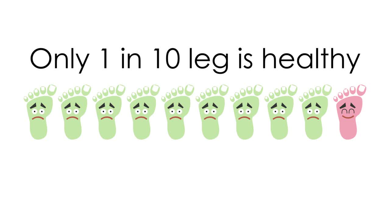 발 보디아트리 의료 인포그래픽 개념: 인간 발 해부학 - 군중 개념 밖에서