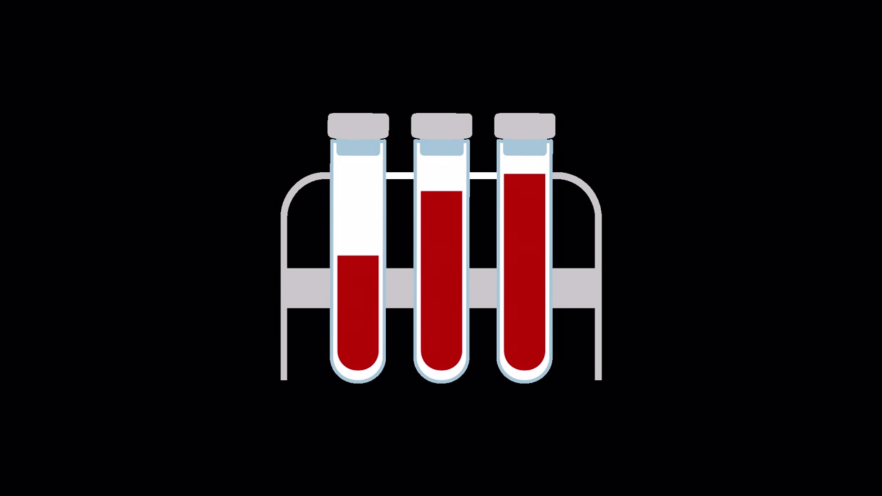 Provette animate che si riempiono di sangue in una rastrelliera da laboratorio
