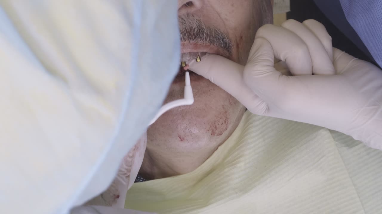 Dentist fitting dentures on a patient during a dental restoration procedure