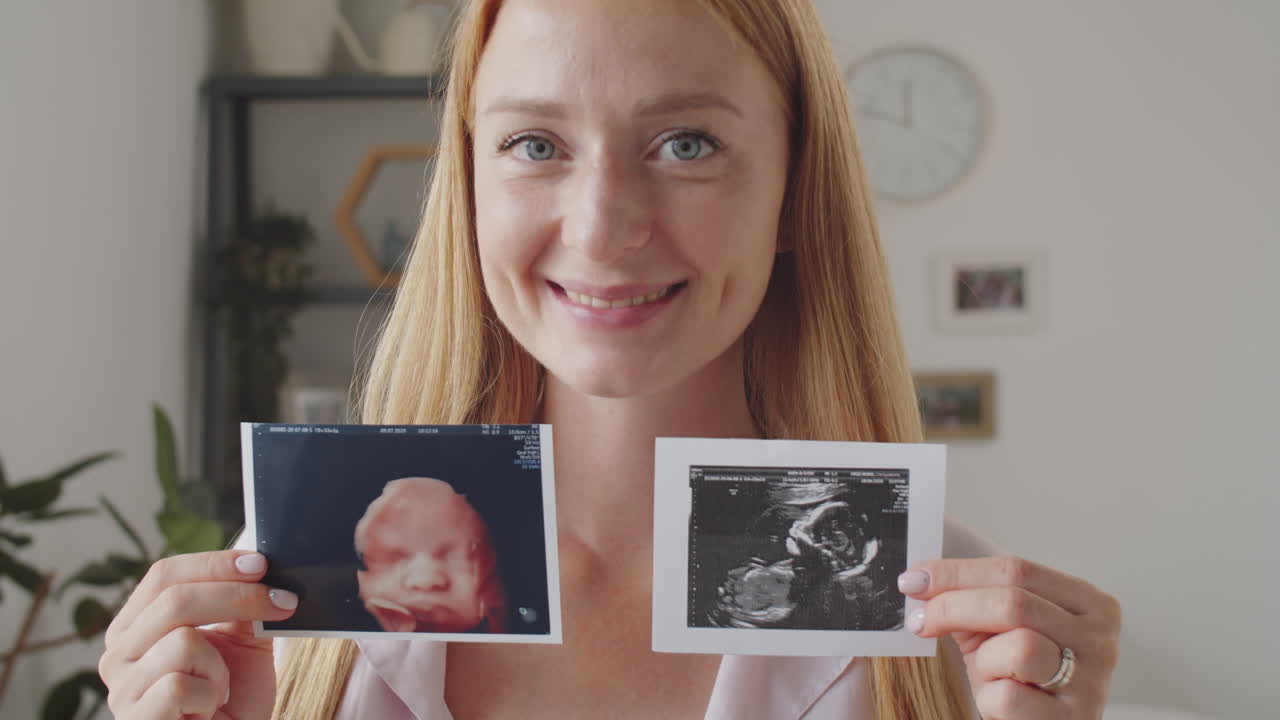 mujer embarazada feliz mostrando imágenes de ultrasonido