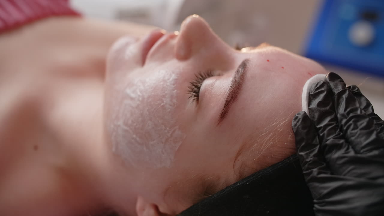 procedimiento de inyección facial