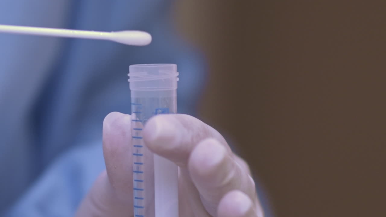 el médico coloca una muestra de prueba de covid-19 en un tubo de hisopo sellado