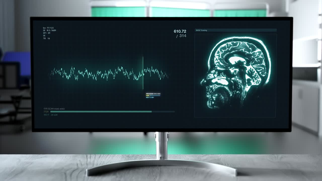 Medisinsk skjerm viser hjerneskanning og pasientdata
