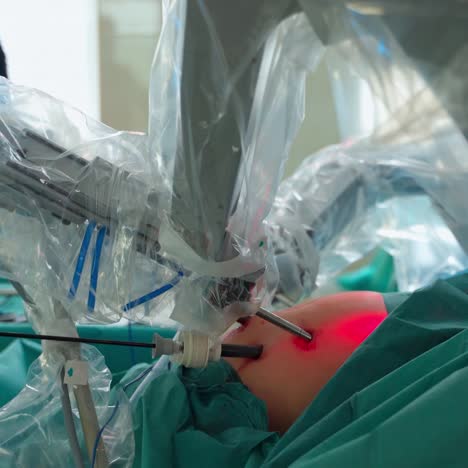 micro surgery with surgery robot. surgeon using robotic arms during robotic surgery