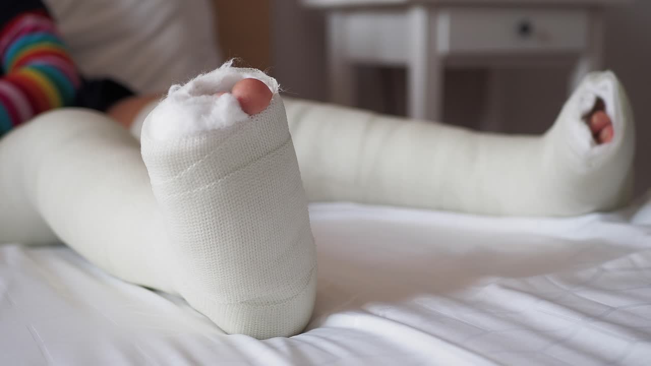 niño con una pierna enjunta en una cama de hospital