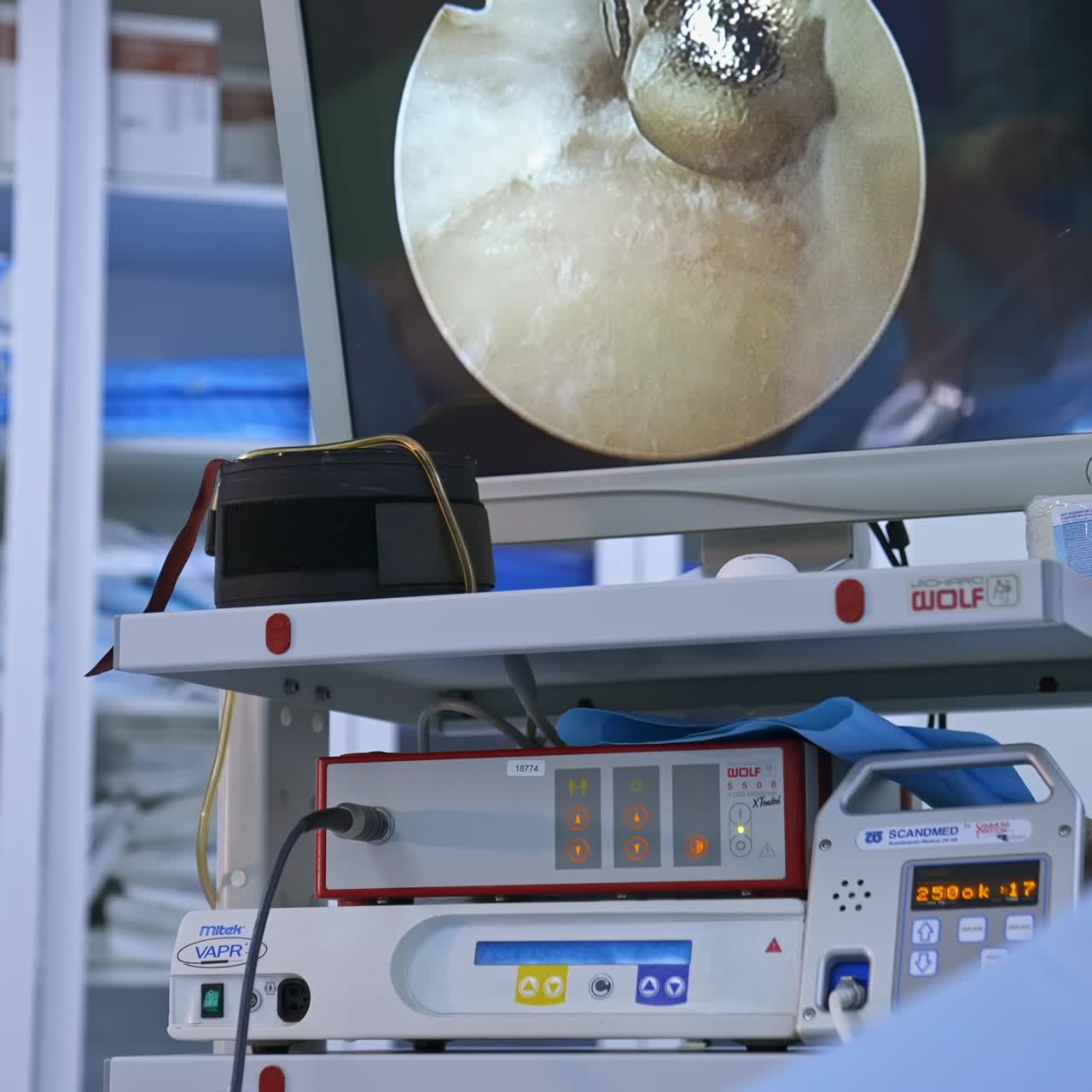 Surgical Laparoscopic Medical Operation