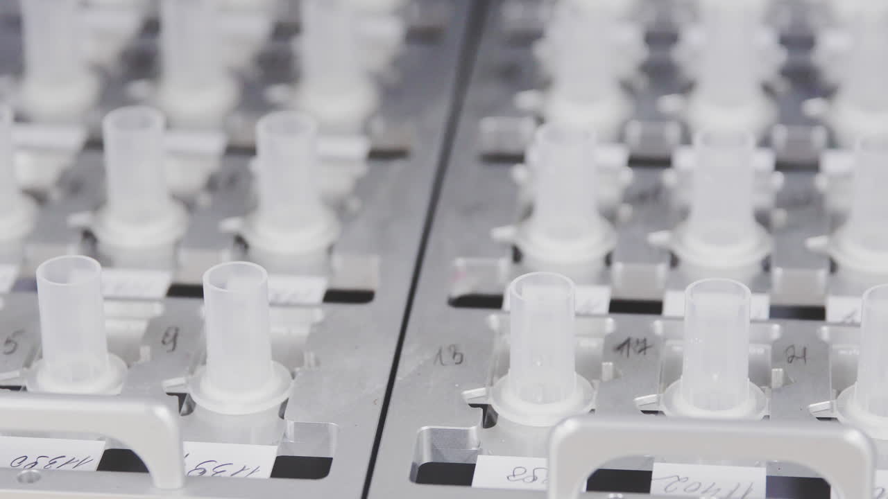 In the medical center in the laboratory, the robot automatically analyzes the detection of cancer cells in patient samples. Prevention and diagnosis of women's cancer