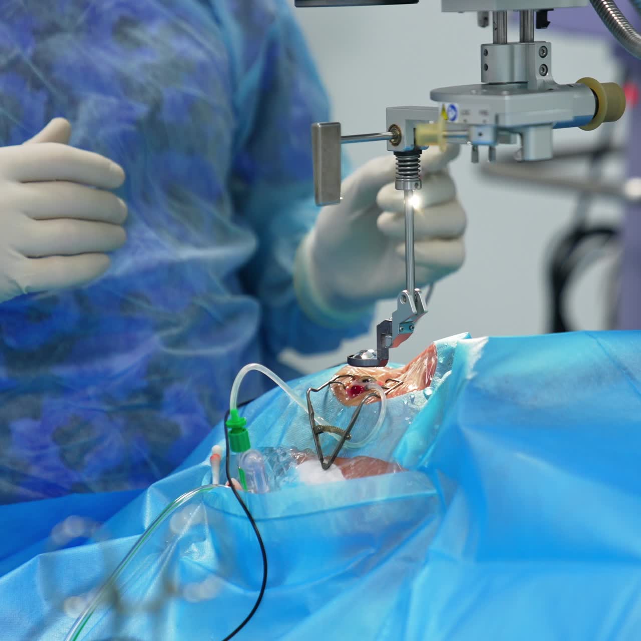 Surgeon inserts medicines into eye of a patient. Male ophthalmology specialist performing eyesight operation