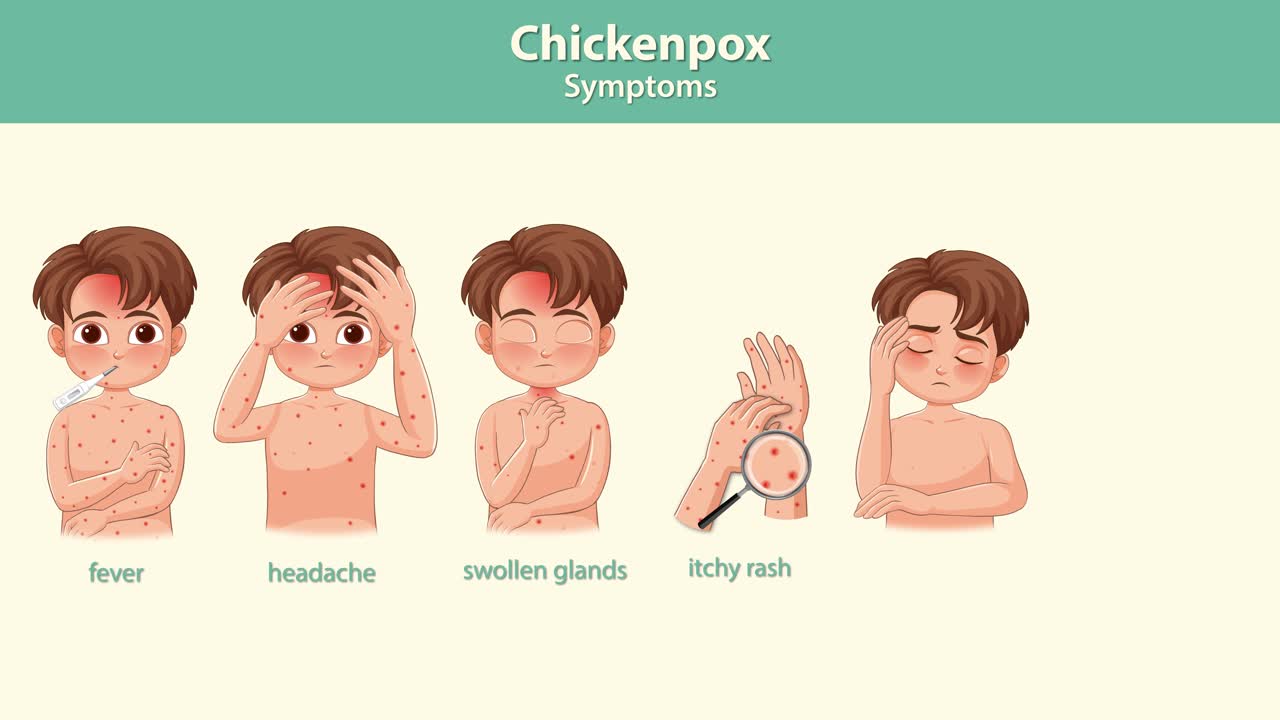 Animated boy demonstrates chickenpox symptoms including fever, rash, fatigue, and loss of appetite