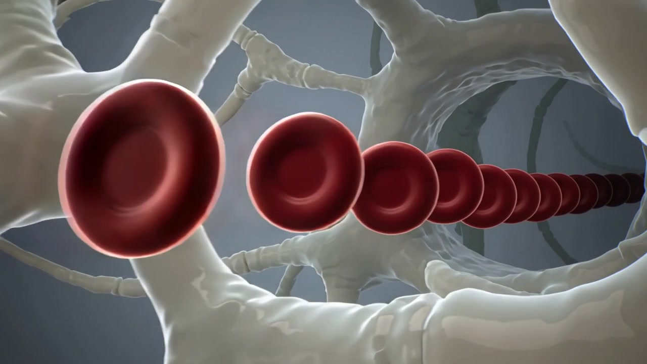 Camera tracking forward, red blood cells flowing down vessel to circulate, with adhered red element