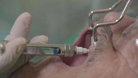 dentist administering precise injection into patient's mouth during dental procedure