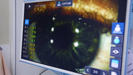 patient's eye on ophthalmologist's monitor. eye examination test on a professional medical equipment screen. close-up.