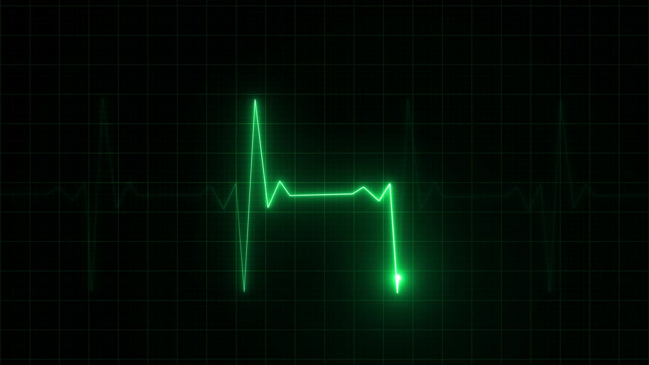 Heart Rate Monitor Electrocardiogram Ekg Or Ecg Looping background