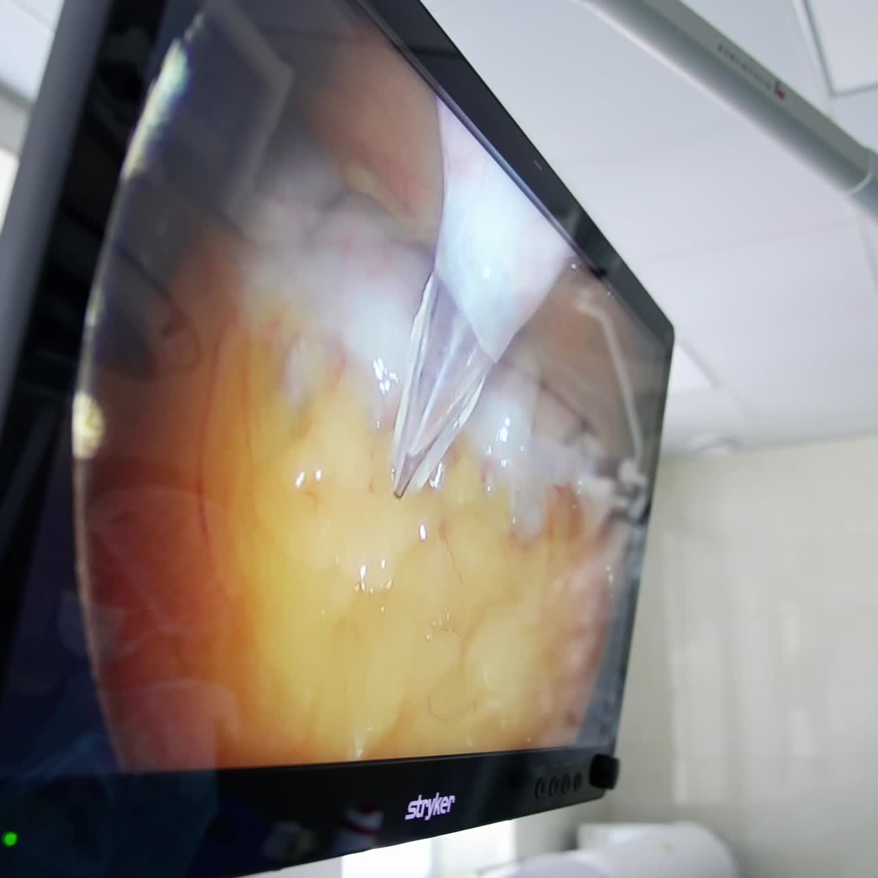 Monitor with cardiogram in hospital. Monitor vital signs for patient in hospital