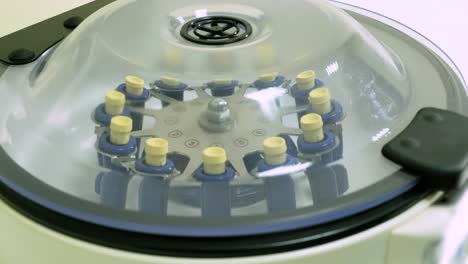 preparación de plasma rico en plaquetas. tubo con sangre en las manos. centrifugadora.