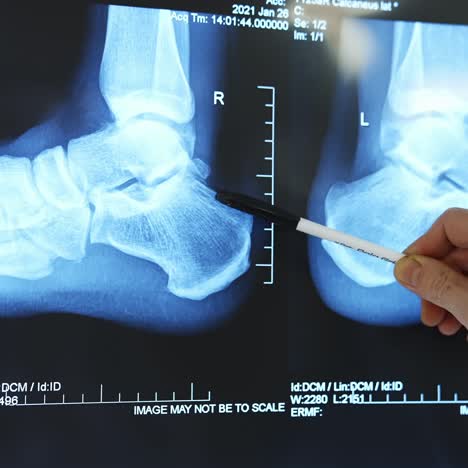 doctor looking at foot x-ray