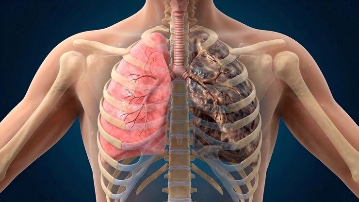 Detailed medical scan of human lungs